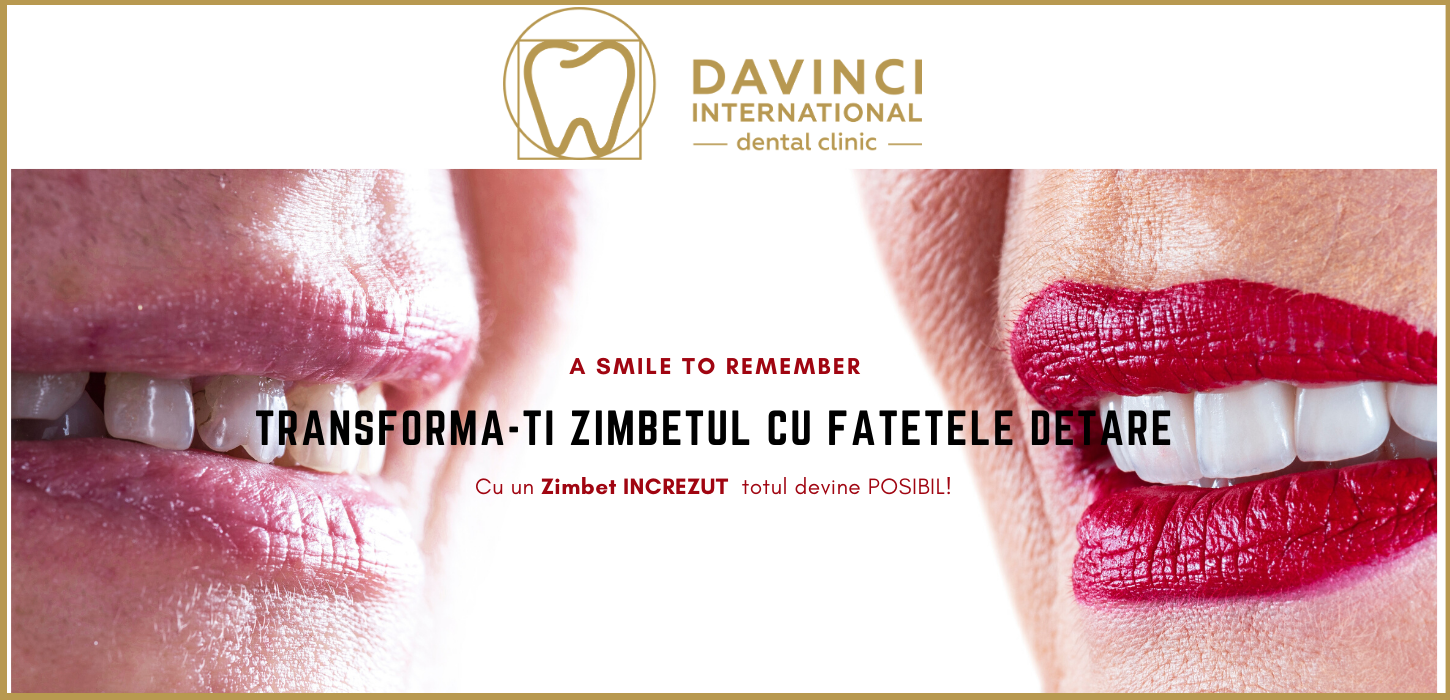 fatete dentare din ceramica, zirconiu, digital smile design